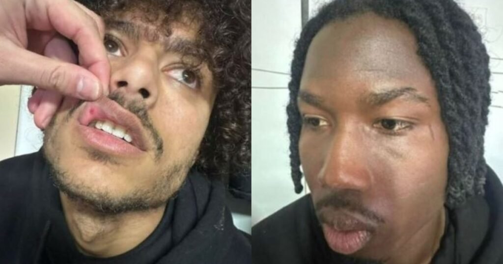 Policia nis hetimet për dy lojtarët e Ilirisë pas dhunës ndaj futbollistëve të Skënderbeut