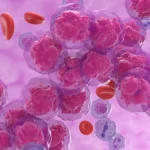 Parandaloni kancerin para se të fillojë