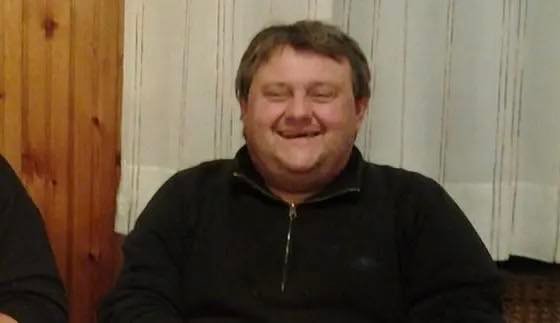 Vdekja e italianit në Tiranë: Mjekët i hoqën organet, trupin e mbushur me lesh e nisën në Itali