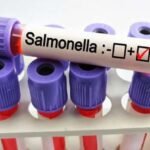 Alarm për salmonelë në Greqi, mbi 20 persona të infektuar