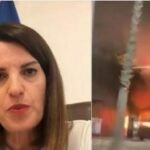 Dergohet ne Turqi e reja qe pesoi djegie si pasojë e zjarrit të rënë në hotelin “Brooklyn” në Vlorë