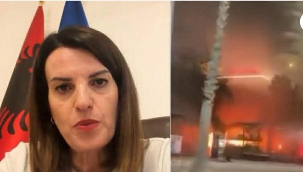 Dergohet ne Turqi e reja qe pesoi djegie si pasojë e zjarrit të rënë në hotelin “Brooklyn” në Vlorë